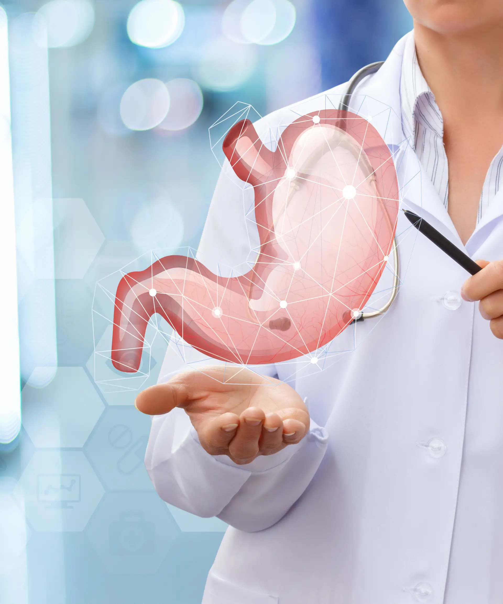 Gastric Balloon Operation